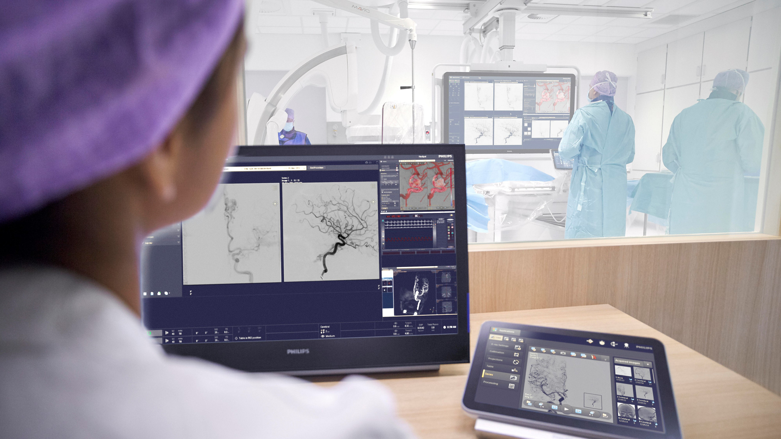 Philips targets robotic stroke treatment Philips targets robotic stroke treatment